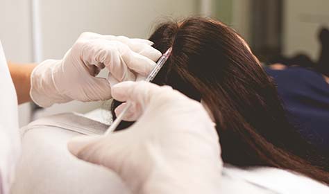 Why is BIO IPT better than FUE hair transplant?