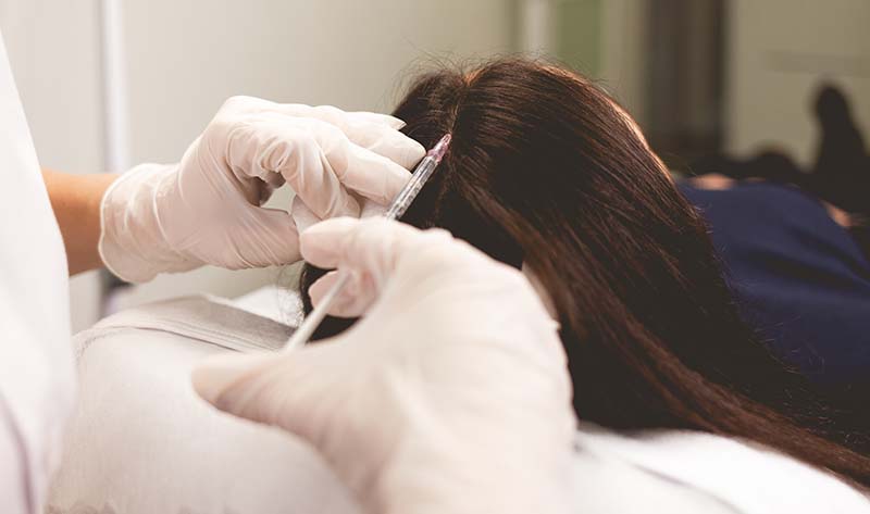 hair line post hair transplant