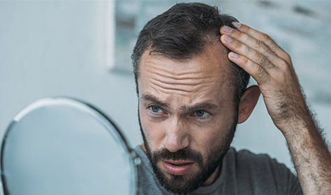 androgentic alopecia corrected