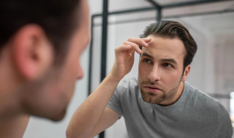 hair line post hair transplant