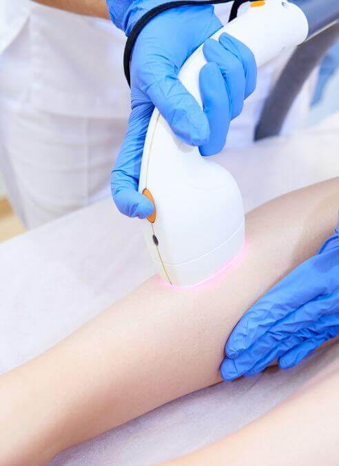 Various technologies available for Laser Hair Removal in Delhi, Pitampura include diode, IPL, ND-YAG, and triple wavelength laser. Consult with doctor today!