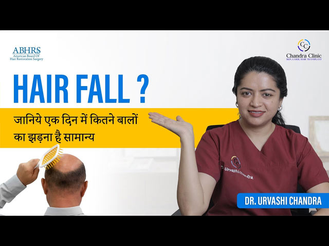 How much Hair Fall is Normal Per Day? | एक दिन में कितने बाल झड़ना नॉर्मल है