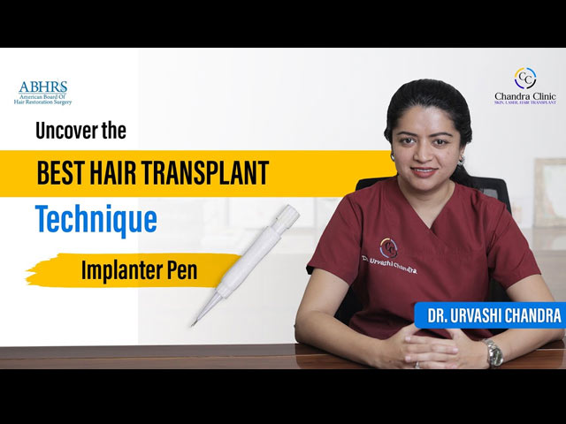 Implanter Pen Hair Transplant Technique: The Future of Hair Restoration? | Dr. Urvashi Chandra