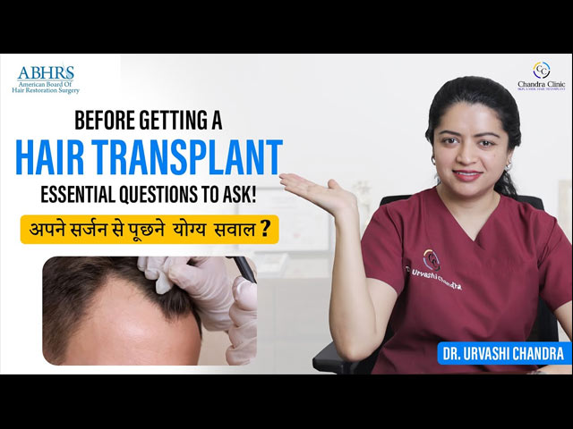 Hair Transplant: Here Are the Top Questions to Ask Before You Go! | Dr. Urvashi Chandra